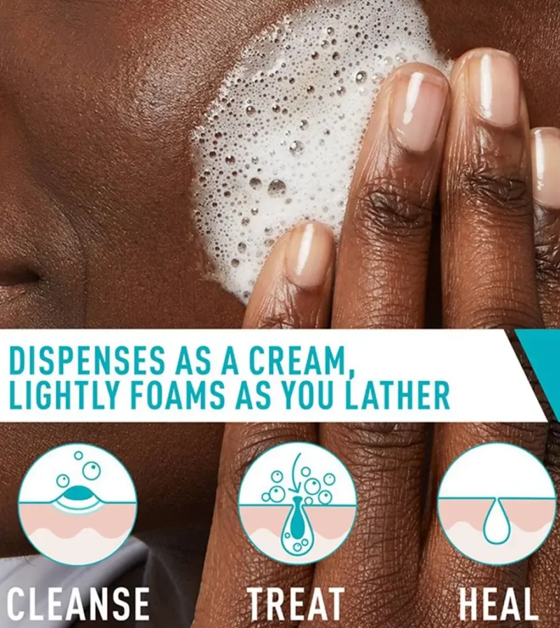 cerave-acne-foaming-cream-cleanser